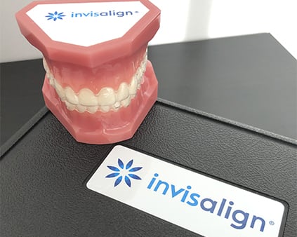 Invisalign Step 1, Port Moody Dentist